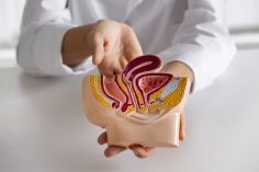 alimente să consumi pentru a reduce riscul de cancer de colon